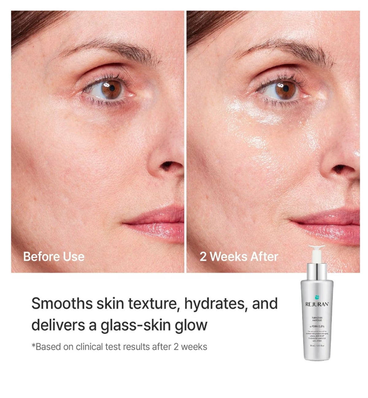 Rejuran Ampoule